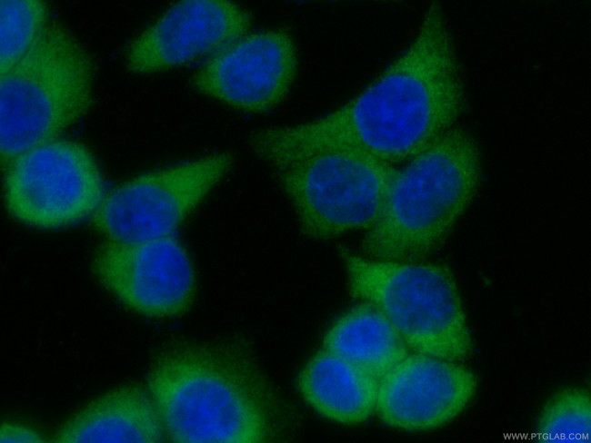 EEF1D Antibody in Immunocytochemistry (ICC/IF)