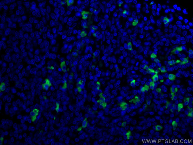 Human IgA Antibody in Immunohistochemistry (PFA fixed) (IHC (PFA))