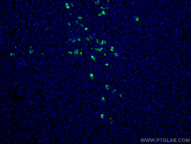 Human IgA Antibody in Immunohistochemistry (PFA fixed) (IHC (PFA))