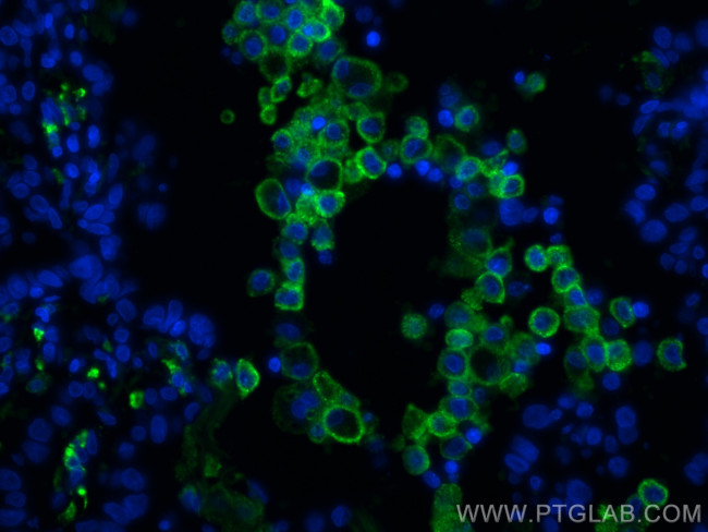 CD206 Antibody in Immunohistochemistry (PFA fixed) (IHC (PFA))