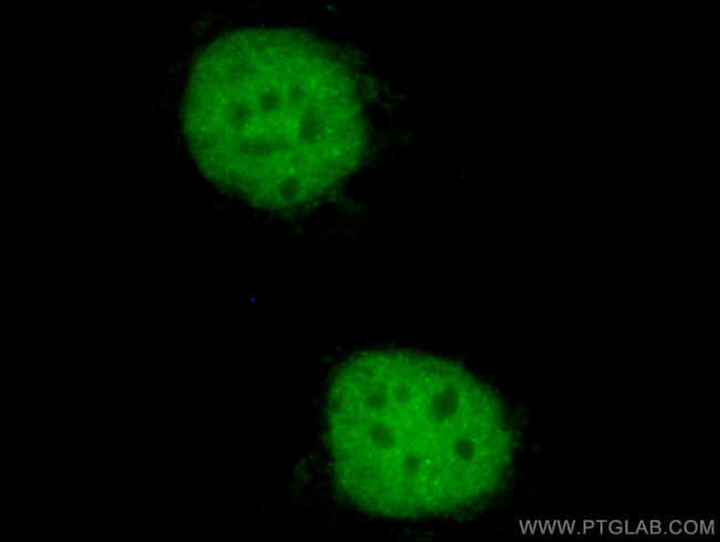 PAX8 Antibody in Immunocytochemistry (ICC/IF)