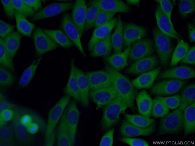 Cytokeratin 19 Antibody in Immunocytochemistry (ICC/IF)