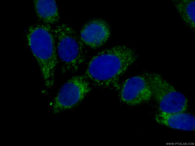 peroxiredoxin 2 Antibody in Immunocytochemistry (ICC/IF)