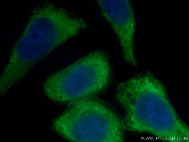 AKT Antibody in Immunocytochemistry (ICC/IF)