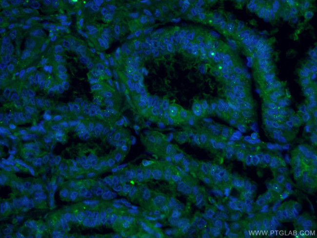 Galectin-3 Antibody in Immunohistochemistry (PFA fixed) (IHC (PFA))