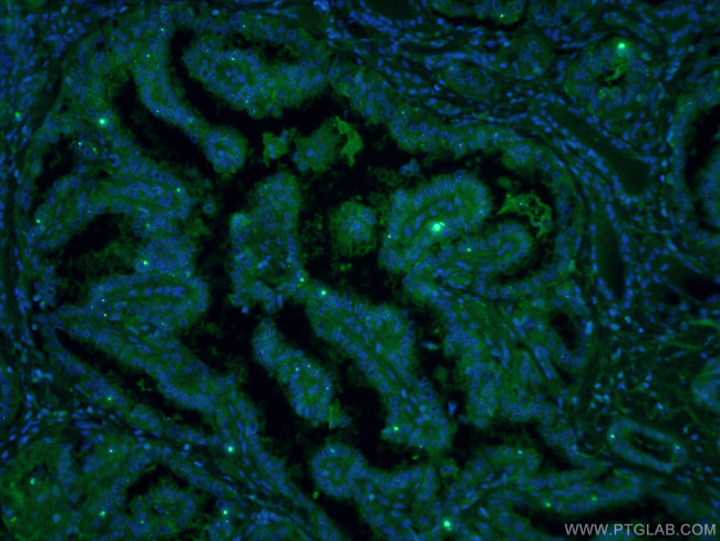 Galectin-3 Antibody in Immunohistochemistry (PFA fixed) (IHC (PFA))