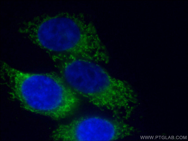 HADHA Antibody in Immunocytochemistry (ICC/IF)