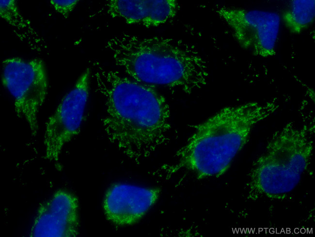 Napsin A Antibody in Immunocytochemistry (ICC/IF)