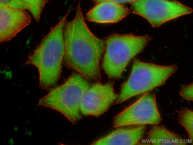 PKM2-specific Antibody in Immunocytochemistry (ICC/IF)