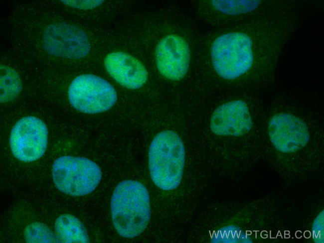 P53 Antibody in Immunocytochemistry (ICC/IF)