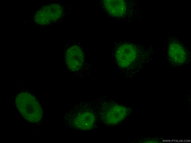 U2AF35 Antibody in Immunocytochemistry (ICC/IF)