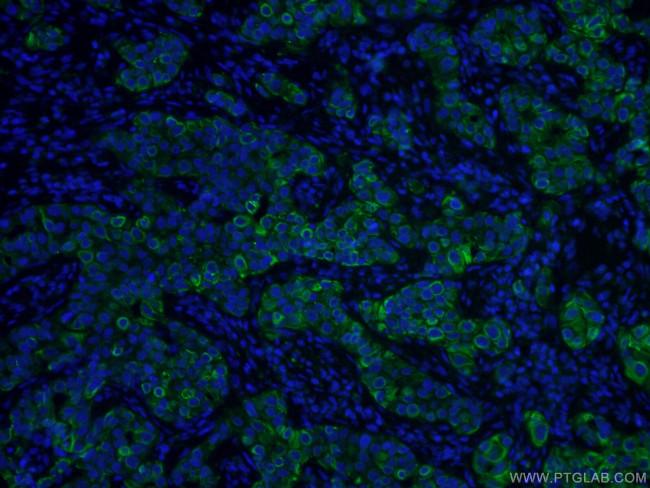 TNF alpha Antibody in Immunohistochemistry (PFA fixed) (IHC (PFA))