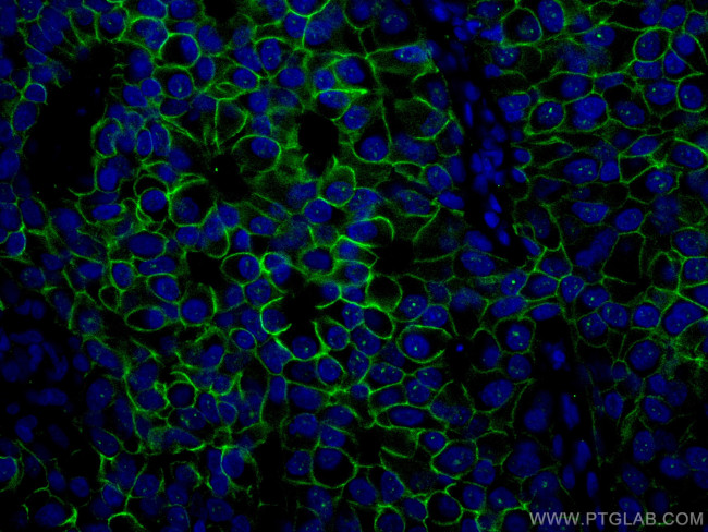 HER2/ErbB2 Antibody in Immunohistochemistry (PFA fixed) (IHC (PFA))