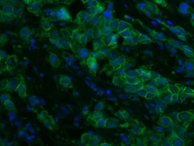 HER2/ErbB2 Antibody in Immunohistochemistry (PFA fixed) (IHC (PFA))