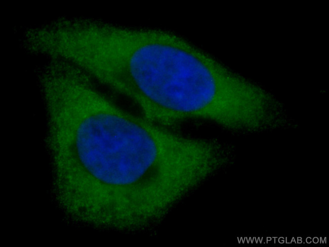 GOT1 Antibody in Immunocytochemistry (ICC/IF)