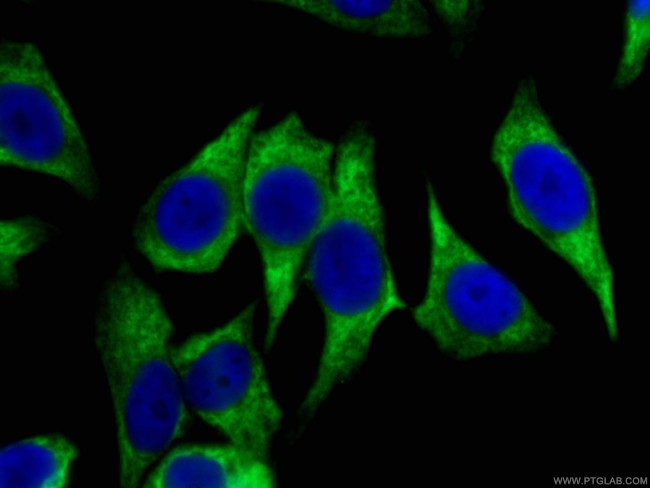 HSP90 Antibody in Immunocytochemistry (ICC/IF)