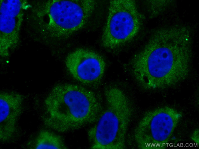 Cytokeratin 14 Antibody in Immunocytochemistry (ICC/IF)