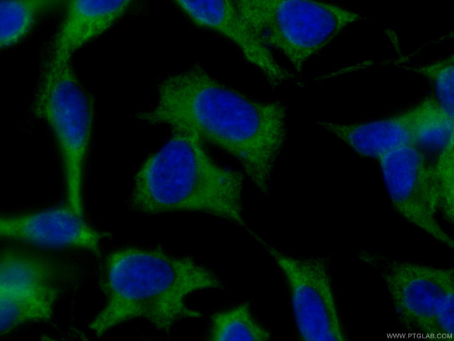 EEF1B2 Antibody in Immunocytochemistry (ICC/IF)