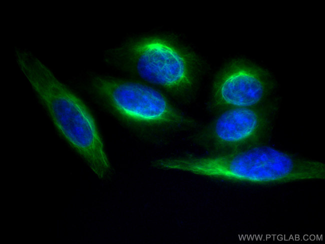 Vimentin Antibody in Immunocytochemistry (ICC/IF)