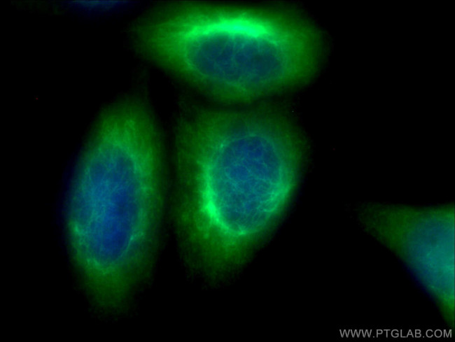 Vimentin Antibody in Immunocytochemistry (ICC/IF)