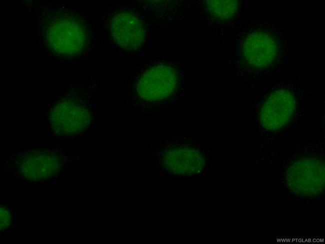 Transketolase Antibody in Immunocytochemistry (ICC/IF)