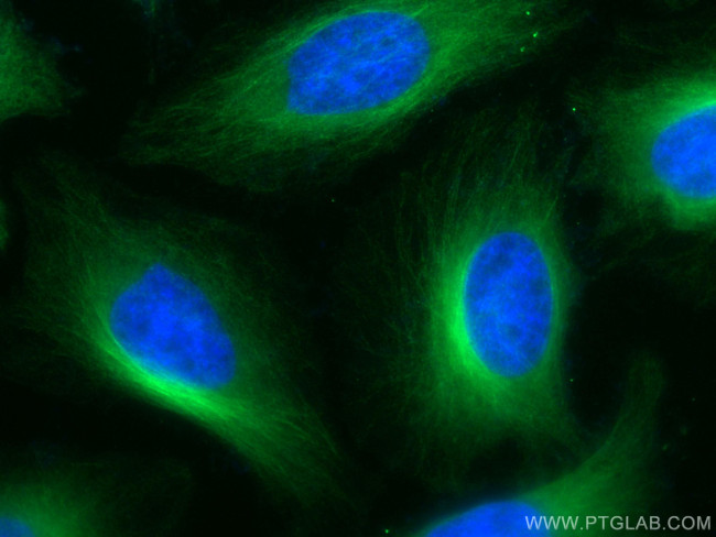 alpha Tubulin Antibody in Immunocytochemistry (ICC/IF)