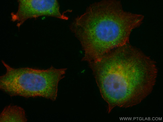 ASS1 Antibody in Immunocytochemistry (ICC/IF)