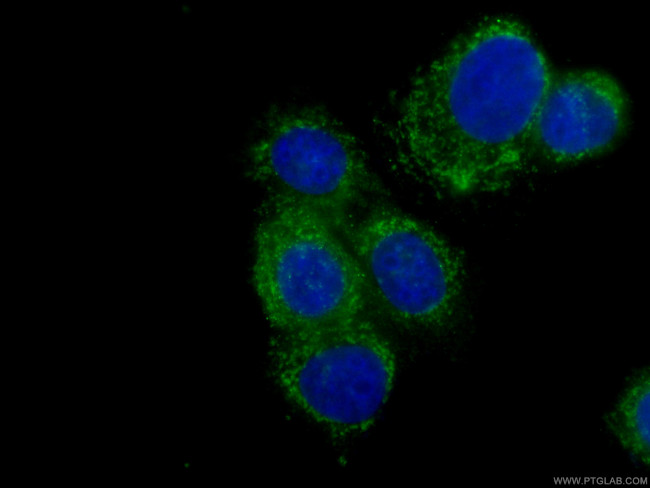 ASS1 Antibody in Immunocytochemistry (ICC/IF)