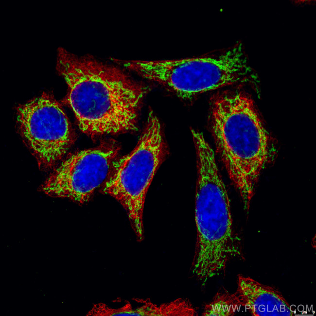 ATP5A1 Antibody in Immunocytochemistry (ICC/IF)