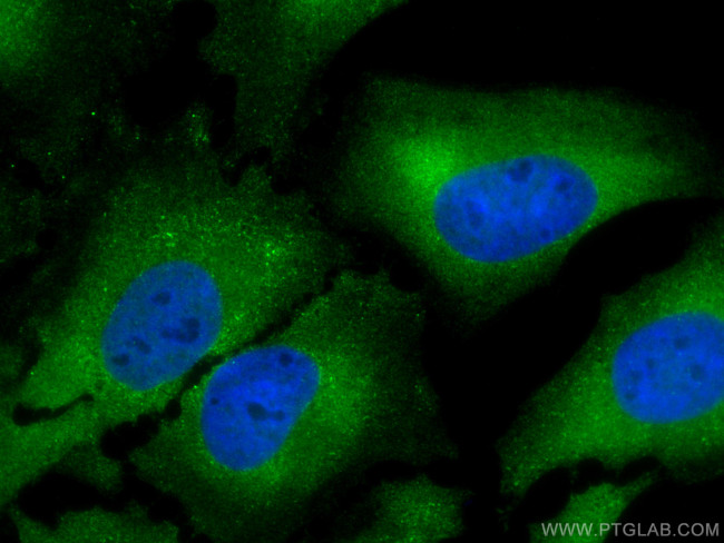 FKBP52 Antibody in Immunocytochemistry (ICC/IF)