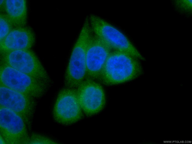 LPCAT1 Antibody in Immunocytochemistry (ICC/IF)