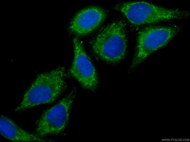 RPS3 Antibody in Immunocytochemistry (ICC/IF)