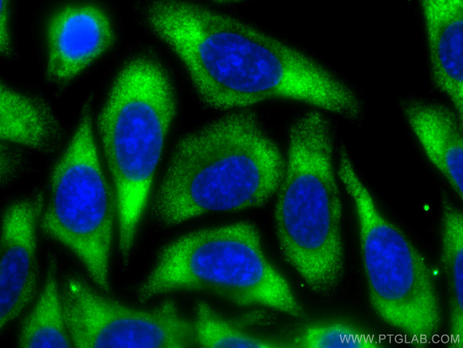 Albumin Antibody in Immunocytochemistry (ICC/IF)