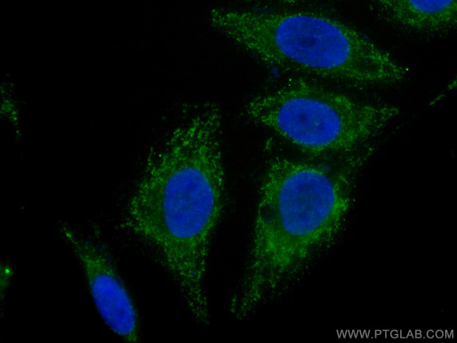 Albumin Antibody in Immunocytochemistry (ICC/IF)