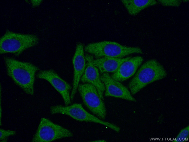 14-3-3 Antibody in Immunocytochemistry (ICC/IF)