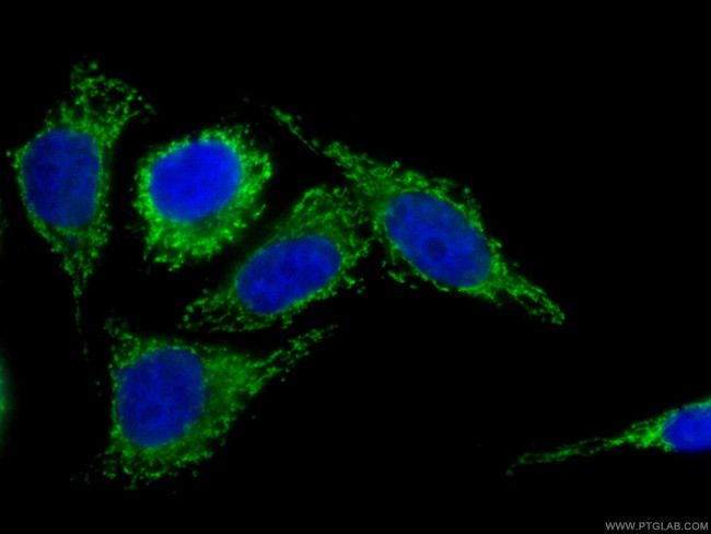 Factor XII Antibody in Immunocytochemistry (ICC/IF)