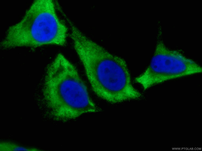 Caspase 8/p43/p18 Antibody in Immunocytochemistry (ICC/IF)