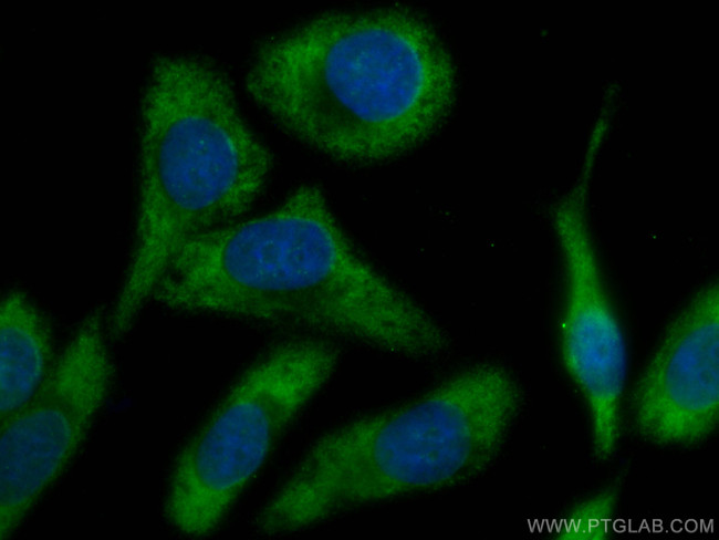 Fetuin-A Antibody in Immunocytochemistry (ICC/IF)