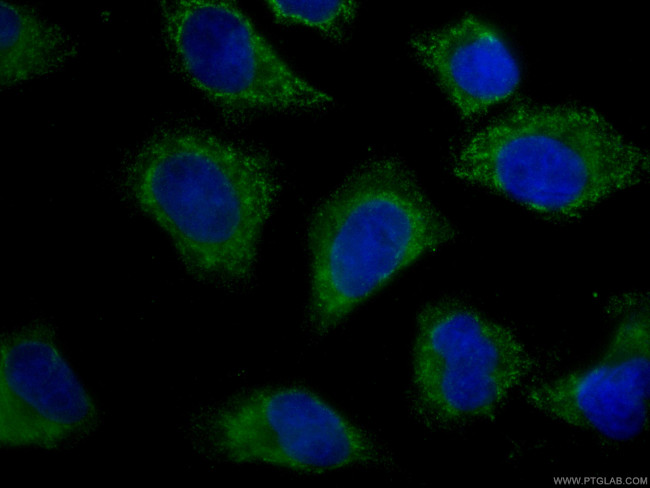 Fetuin-A Antibody in Immunocytochemistry (ICC/IF)