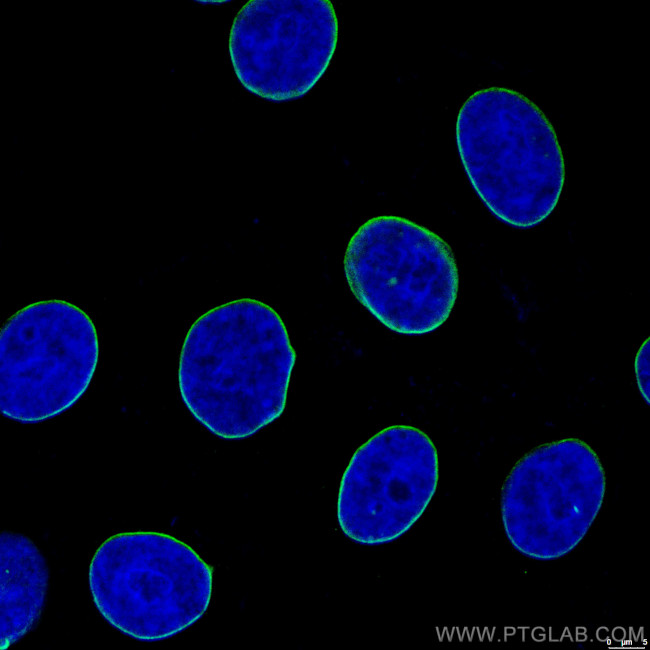 Lamin B1 Antibody in Immunocytochemistry (ICC/IF)