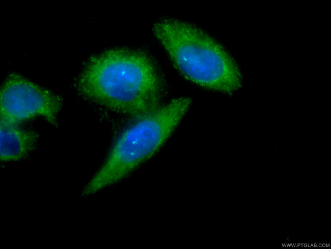 AFM Antibody in Immunocytochemistry (ICC/IF)