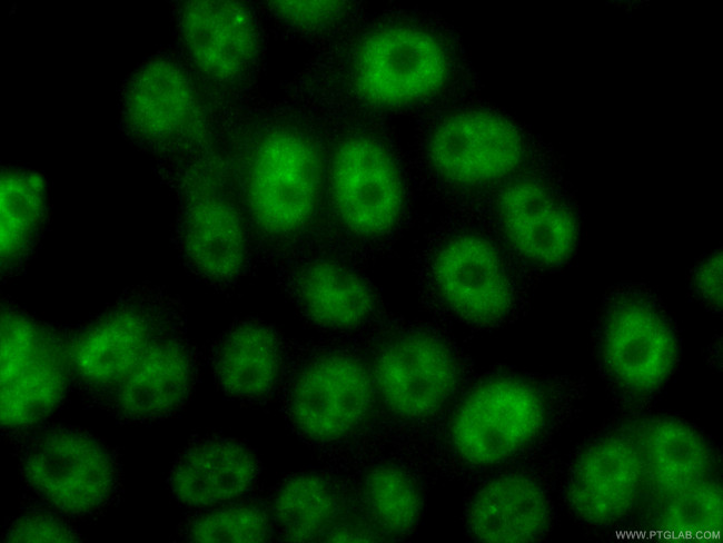 TFIP11 Antibody in Immunocytochemistry (ICC/IF)