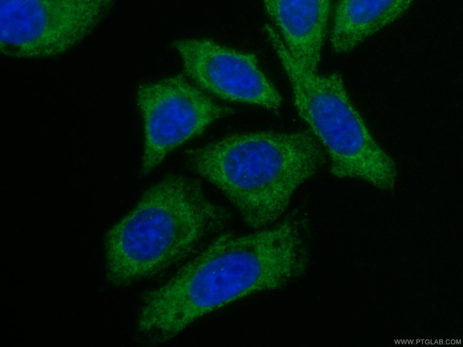 Alpha galactosidase A Antibody in Immunocytochemistry (ICC/IF)