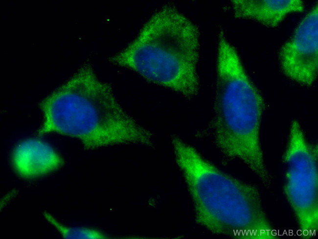 RAC1 Antibody in Immunocytochemistry (ICC/IF)