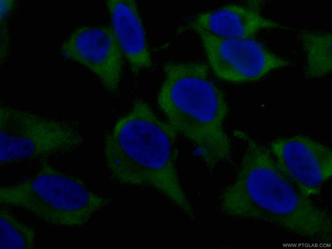 RAC1 Antibody in Immunocytochemistry (ICC/IF)