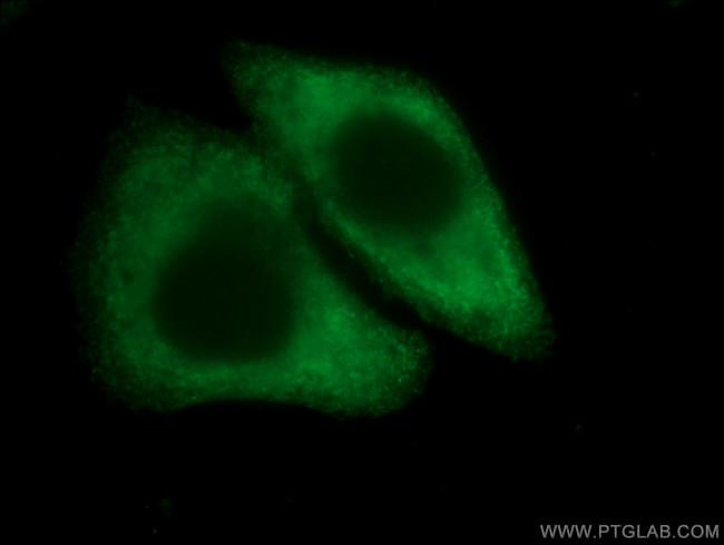 ARG1 Antibody in Immunocytochemistry (ICC/IF)