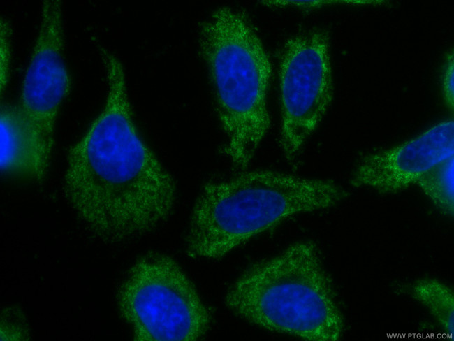 Alpha-1-Antitrypsin Antibody in Immunocytochemistry (ICC/IF)