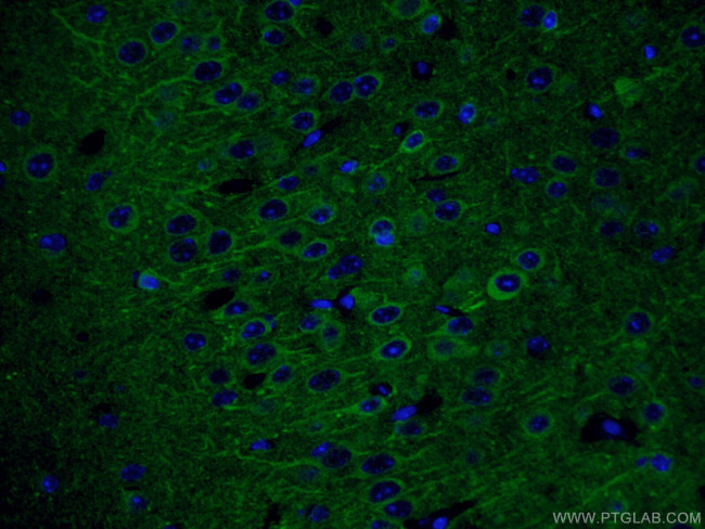 NSE Antibody in Immunohistochemistry (PFA fixed) (IHC (PFA))