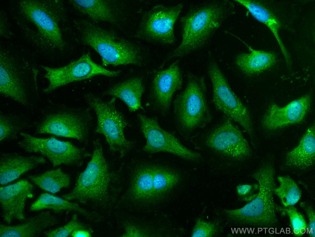 Caspase 9/p35/p10 Antibody in Immunocytochemistry (ICC/IF)