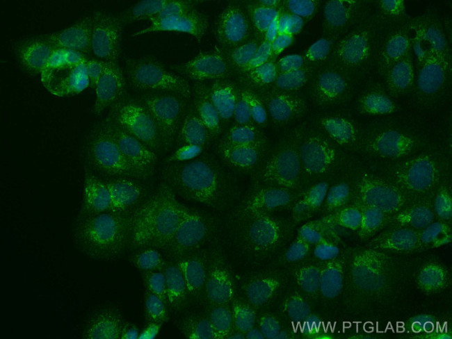 RCAS1 Antibody in Immunocytochemistry (ICC/IF)